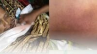 Tahanan Narkoba Polres Parepare Meninggal dengan Luka Lebam, Keluarga Minta Investigasi